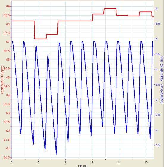 Selección del gráfico de forma de onda Por omisión, MultiLab visualiza el gráfico de frecuencia cardíaca en latidos por minuto.