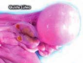 Ovarios inactivos: Desarrollo folicular mínimo, anovulación y ausencia de desarrollo del cuerpo lúteo. 2. Ovulación silenciosa: Ovulación sin comportamiento de estro. 3.