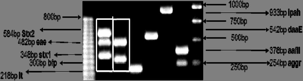 amplificación de DNA de las categorías de E.