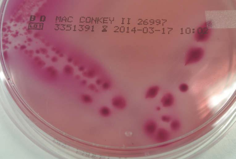 Se utiliza para el aislamiento y diferenciación de enterobacterias fermentadoras y no fermentadoras de lactosa. El crecimiento de E. Coli aparece oscuro y con brillo verde metálico. Figura 2.