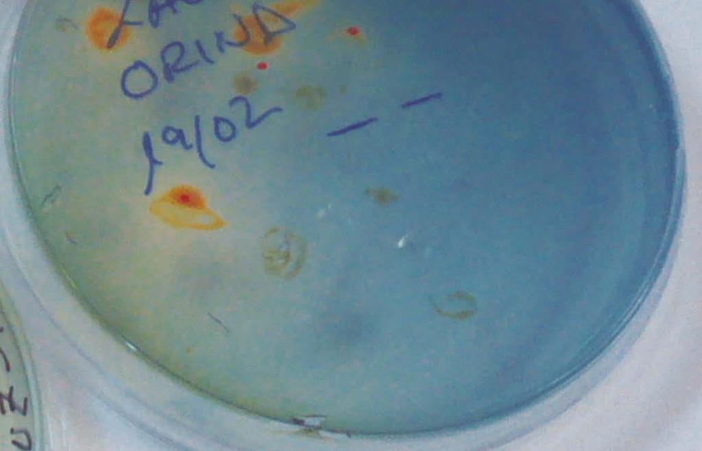 Lactosa (Salmonella y Shigella): incoloras. Salmonella aparece con un precipitado negro por la producción de H 2 S. k) Agar xilosa lisina desoxicolato XLD.