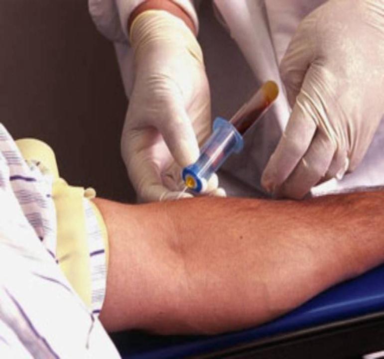 Muestra para el diagnóstico serológico: Detección de anticuerpos IgM e IgG Suero sanguíneo Extraer 5 ml de sangre venosa sin anticoagulante.