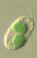 que retienen pared celular de péptido-glicano intermediario en la evolución de los cloroplastos?