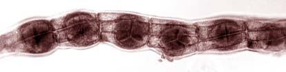 Rhodophyta: ciclos de vida La mayoría presenta un ciclo de vida con tres fases adultas: tetraesporofito
