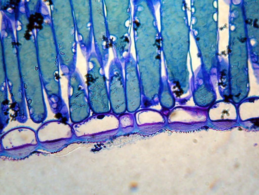 Las células del parénquima () poseen un contenido vacuolar denso y plastos.