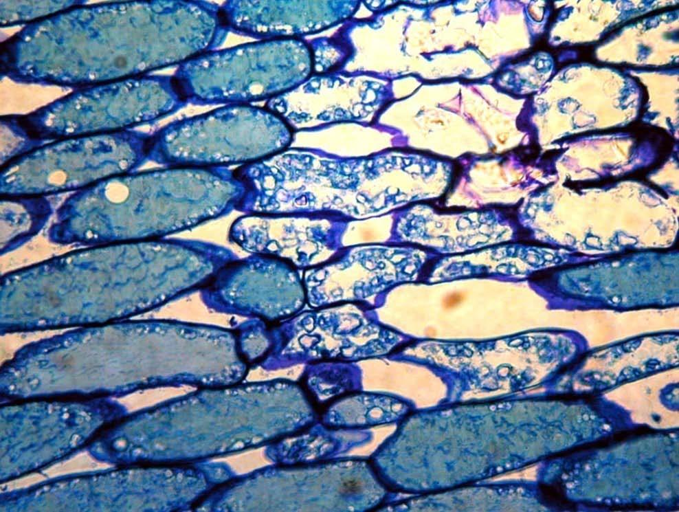 Se observa una degeneración de las vacuolas () y de los cloroplastos (flechas blancas) así como un deterioro evidente de la pared celular ().