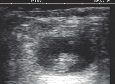 folículos preovulatorios y posteriormente realizar la confirmación de preñez de las vacas inseminadas. Figura 6.