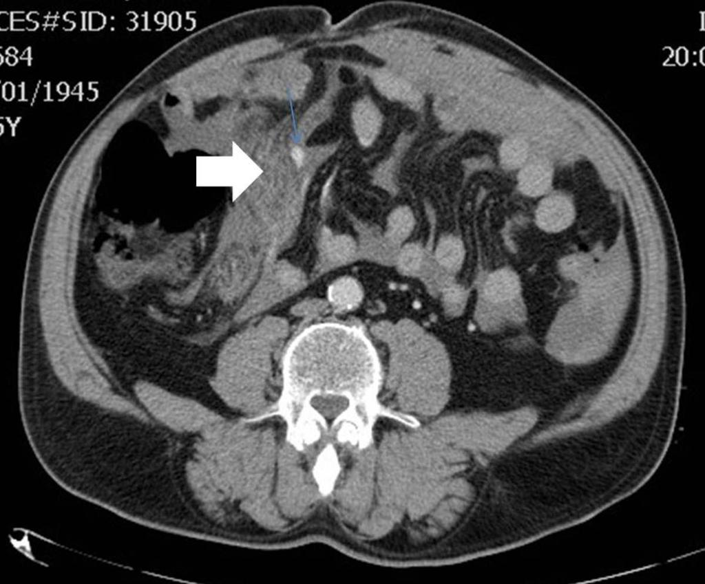Fig. 1: Paciente con traumatismo abdominal como consecuencia de una coz de un caballo.