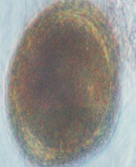 Echeverry DM, Giraldo MI, Castaño JC Figura 3. Huevo de Toxocara cati. Microscopio invertido Olympus CK2, 400X.