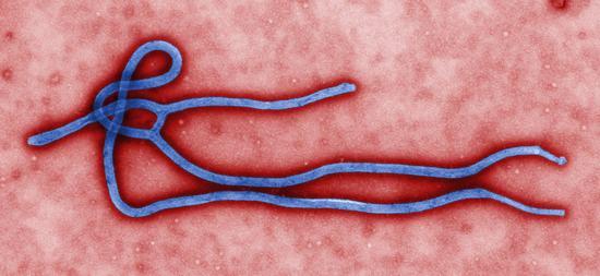 www.juventudrebelde.cu Vista microscópica del virus del Ébola.