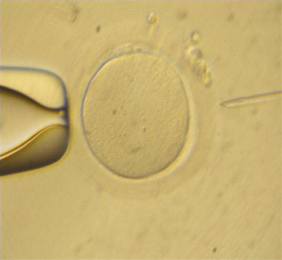 Materiales y Métodos Imagen 8. Secuencia del proceso de la microinyección espermática.