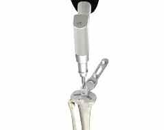 Scorpio NRG Sistema de rodilla primaria de radio único PR Protocolo quirúrgico Perforación de la quilla tibial de la base tibial de la rótula La preparación de una perforación piloto guiará el buje