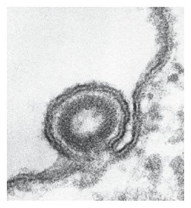 Vías Experimentales Figura 1 Micrografía electrónica de un virus de la leucemia del ratón Friend que se
