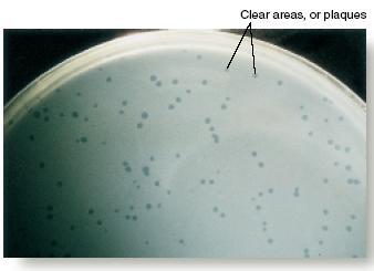 Halos o placas de lisis de los fagos Son