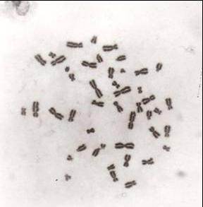 Radiaciones onizantes y alteraciones cromosómicas Fotografía obtenida por microscopia óptica