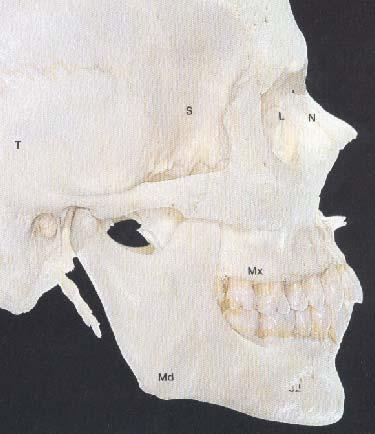Espina nasal posterior 23. Cresta cigomaticoalveolar 24. Proceso pterigoideo 25. Apófisis estiloides 26. Cóndilo 27. Escotadura sigmoidea 28. Apófisis coronoides 29.