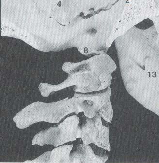 Cuerpo de 3ª vértebra cervical 12. Borde anterior de 3ª vértebra 13.