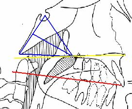 Angulo VT al plano S-N : valora la posición de la cabeza respecto a la 2ª vértebra cervical 152 5. Angulo SN-CV2sp.