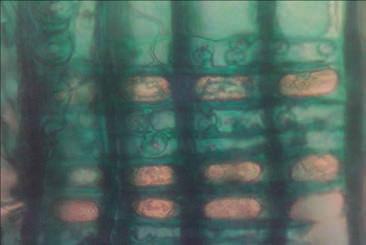 Las características de las estructuras anatómicas microscópicas se analizaron en el microscopio óptico con luz trasmitida previa preparación, tratamiento y tinción de las muestras con verde yodo, se
