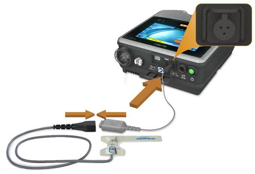 Accesorios Para conectar el pulsioxímetro: 1. Acople el conector del sensor de pulso digital al conector del pulsioxímetro. 2.