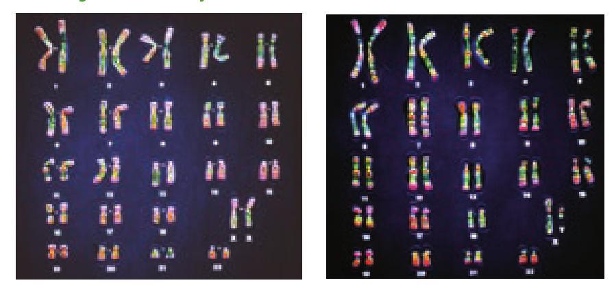 Cariograma (mapa citogenético): imagen de los cromosomas de un individuo ordenados según el tipo tamaño y forma.