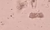 Chroococus sp Reino: Monera División :Cyanophyta Clase : Cyanophyceae Subclase:Oscillatoriophycide ae Orden : Chroococcales Familia: Chroococcaceae En aguas estancadas y lagos eutróficos Cyclotella