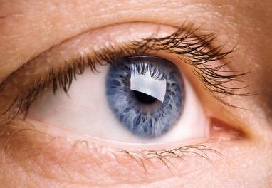 Tratamientos Presbicia Tratamiento con lente intraocular Consiste en extraer el cristalino, que ya ha perdido o está perdiendo su capacidad para enfocar de cerca, y sustituirlo por una lente