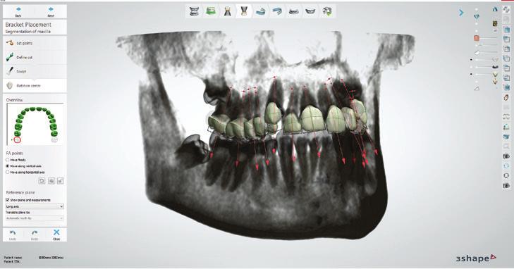 Solución de ortodoncia de 3Shape: solución digital completa para laboratorios y clínicas de ortodoncia Incluya X1 en sus estudios de casos para un diagnóstico más eficiente y la visión clínica