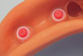 7 Fabricación del modelo maestro Análogospara: Hombro de implante 4,8 mm RN Hombro de implante 6,5 mm WN La fabricación del modelo maestro para el hombro de implante de 4,8 mm RN y el hombro de
