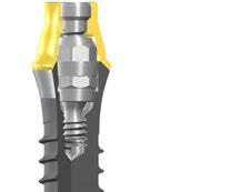 2 Ventajas Fiabilidad. Sencillez. Flexibilidad. El sistema protésico synocta le ofrece las ventajas de una solución protésica fiable, sencilla y flexible.