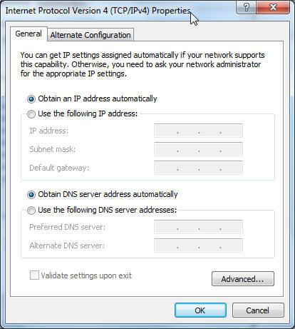 3. Active la opción Obtain an IP address automatically (Obtener una dirección IP automáticamente).