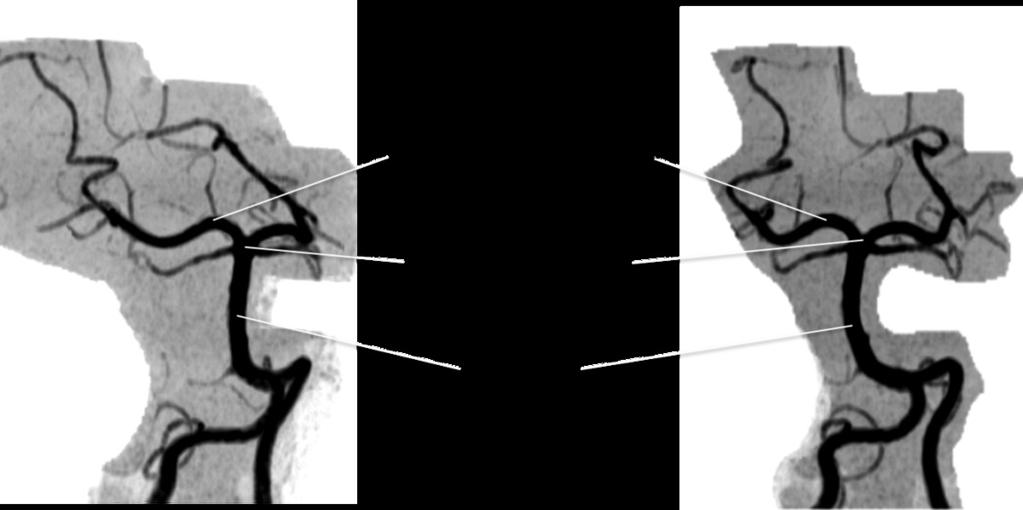 Fig. 7: AngioRM del Polígono de Willis