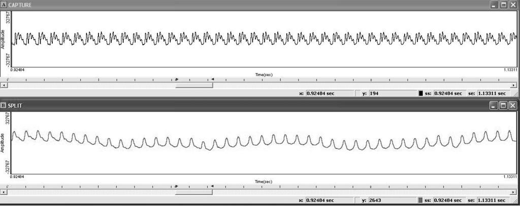 Este tipo de gráfico informa del movimiento de las cuerdas vocales, de las sucesivas aberturas y cierres y, por lo tanto, coincide con los sonidos sonoros.