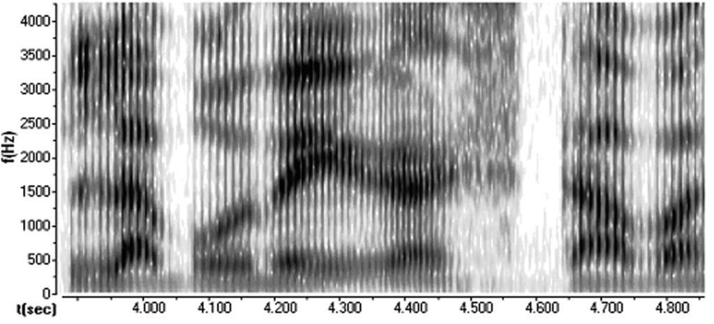 INTRODUCCIÓN 23 FIG. 1.8. Espectrograma sin especificaciones arriba y con algunas especificaciones abajo. bién son totalmente variables.
