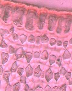 angular, lagunar, laminar y masivo. Angular: con engrosamiento en los ángulos que forman las células al unirse, es muy frecuente, por ejemplo en ombú Phytolacca dioica L.