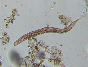 Strogyloides stercoralis Larva
