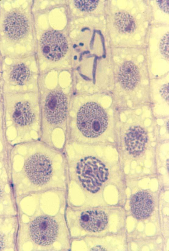 formación Cinetocoro Cromosoma en