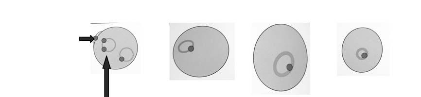 Distribución geográfica Tipo de hematíe que parasita Tamaño del hematíe infectado P. falciparum P. vivax P. ovale P. malariae P.