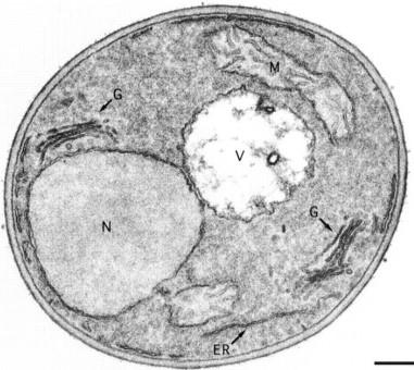 Usualmente haploides 3-40 cromosomas 1-3 m diam La membrana nuclear persiste durante la división.