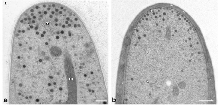 Esquema de ápice. Polaridad Diagrama general y esquemático de la pared Memb. Plasmática Proteínas Proteinas mananos Fusarium solani (Ascomycota) presentando Spitzenkörper.