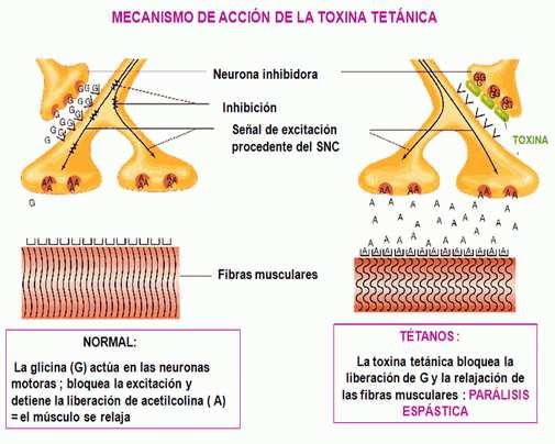 CLOSTRIDIUM TETANI TOXINA TETANICA: El tétanos es causado por la contaminación de heridas punzantes con las bacterias de
