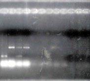 de PCR de una cepa referencial positiva para el gen eae. De este modo, se comprobó la presencia del gen asociado al fenómeno de attaching and effacing en la cepa Tacna410 (Figura Nº3). Figura Nº 1.