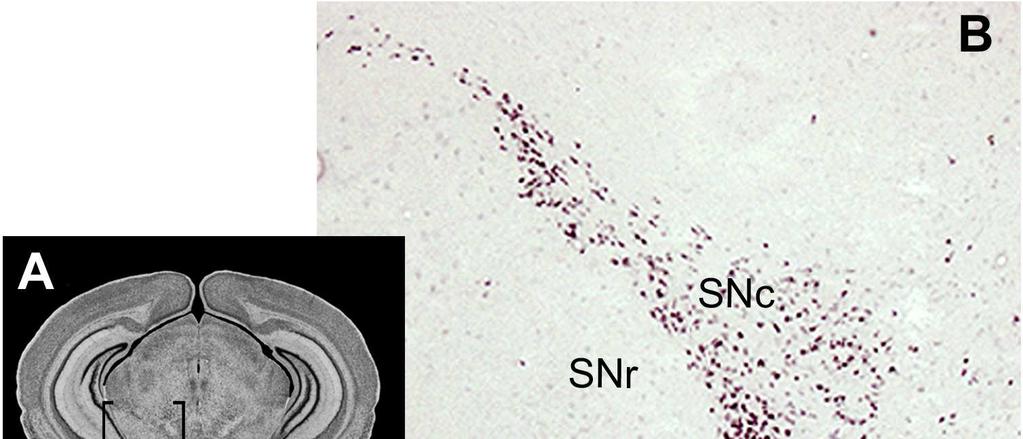 Resultados Figura 12. Las neuronas dopaminérgicas de la SN no expresan el receptor CB 1.