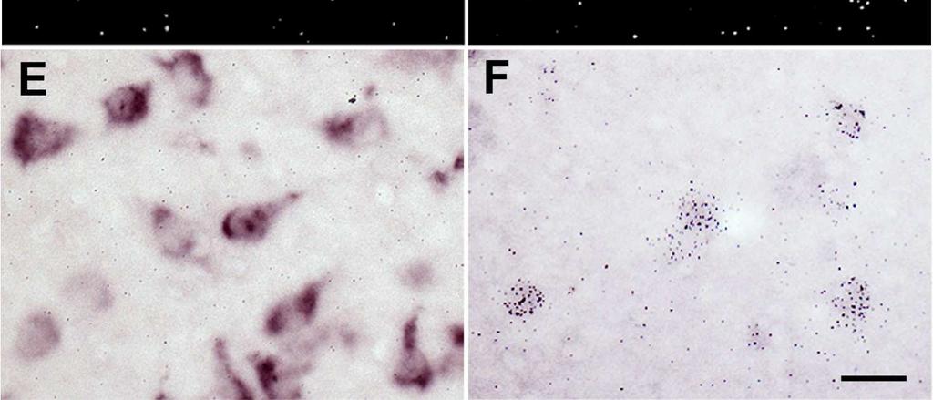 C y E muestran un detalle de la SN tomado de B, con microscopía de campo oscuro (C) y de campo claro (E), donde no se observaron granos de plata en