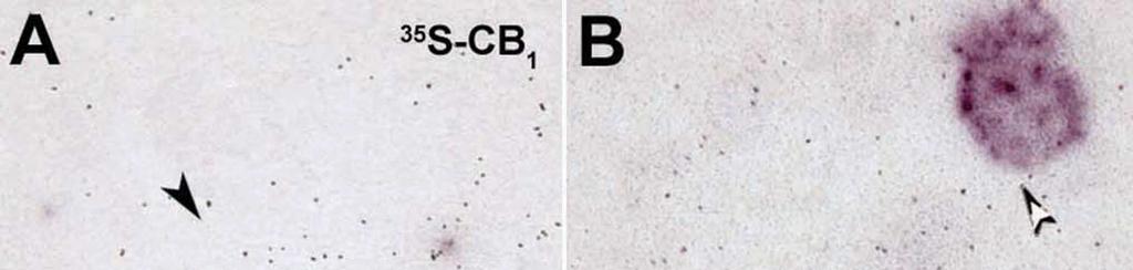 Resultados interneuronas expresan el receptor CB 1, independientemente de su localización en el