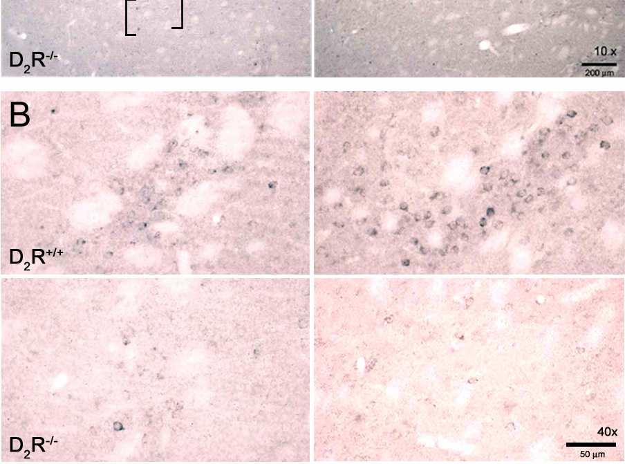 Imágenes (10x) donde se observa mayor expresión de dinorfina en los estriosomas de ratones D 2 R +/+ tratados con salino o con cocaína, mientras que en los ratones D 2 R -/- la