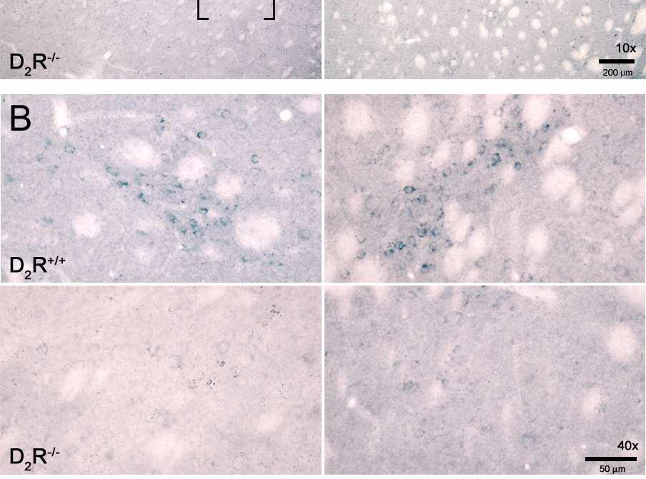 Imágenes (10x) donde se observa mayor expresión de dinorfina en los estriosomas de ratones D 2 R +/+ tratados con salino o con anfetamina, mientras que en los ratones D 2 R -/- la