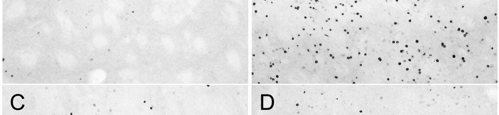 Fotografías de secciones coronales de cerebro de ratón que ilustran la expresión de c-fos tras la