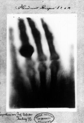Figura 1.13 Radiografía de Ana Bertha Roentgen, esposa del descubridor de los rayos X, tomada el 22 de diciembre de 1895. Los desarrollos de la biología han avanzado al mismo ritmo que la física.