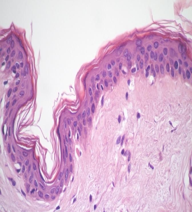 10 b)utilizando la micrografía a mayor aumento de piel, describa la epidermis c) cite todos los tipos celulares que